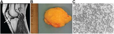 Infrapatellar Fat Pad Stem Cells Responsiveness to Microenvironment in Osteoarthritis: From Morphology to Function